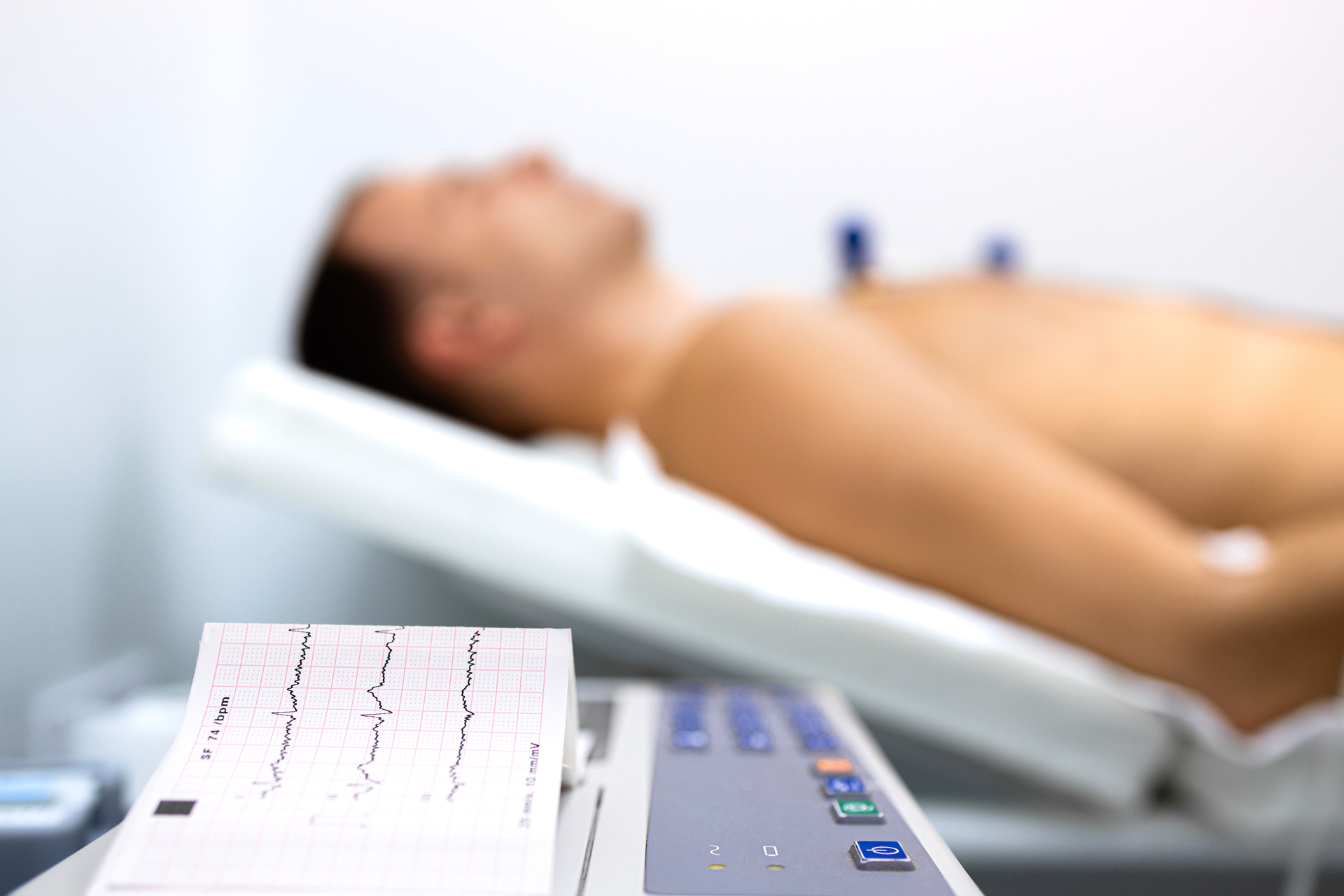 Cardiology examination of patient's heart rhythm. Electrocardiography diagnostic procedure. Electrocardiogram printed on paper.
